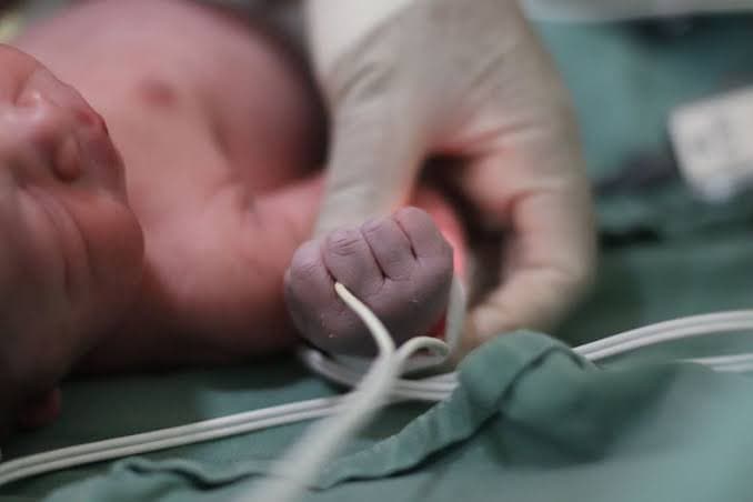 Foto: Web
