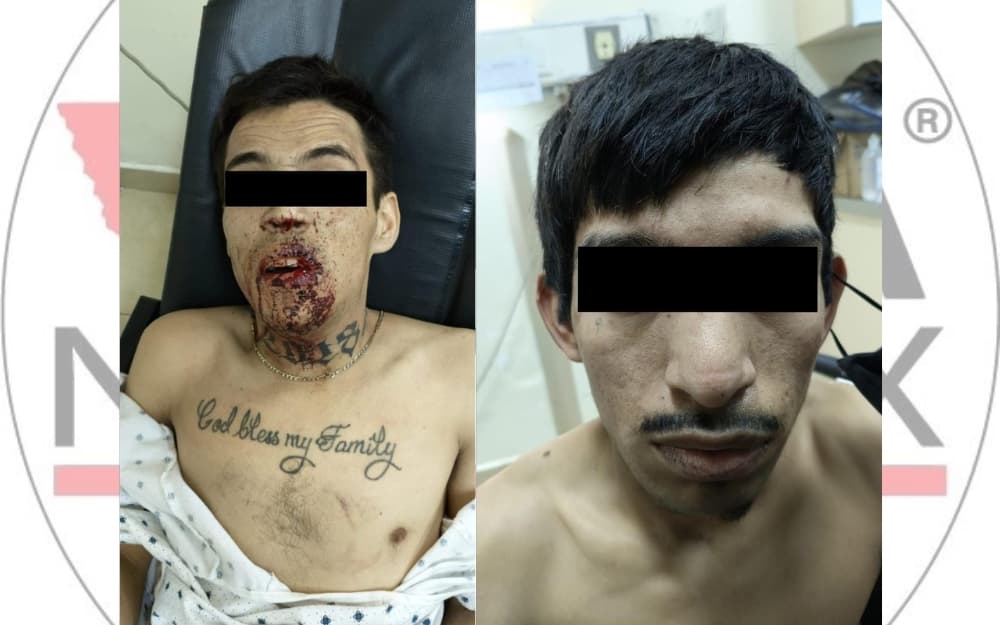 Edgar "N" y Antonio "N" permanecen bajo vigilancia policial mientras reciben atención médica tras ser encontrados en un vehículo reportado como robado.