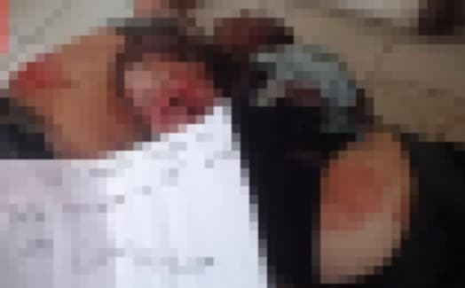 Foto: Border Zoom