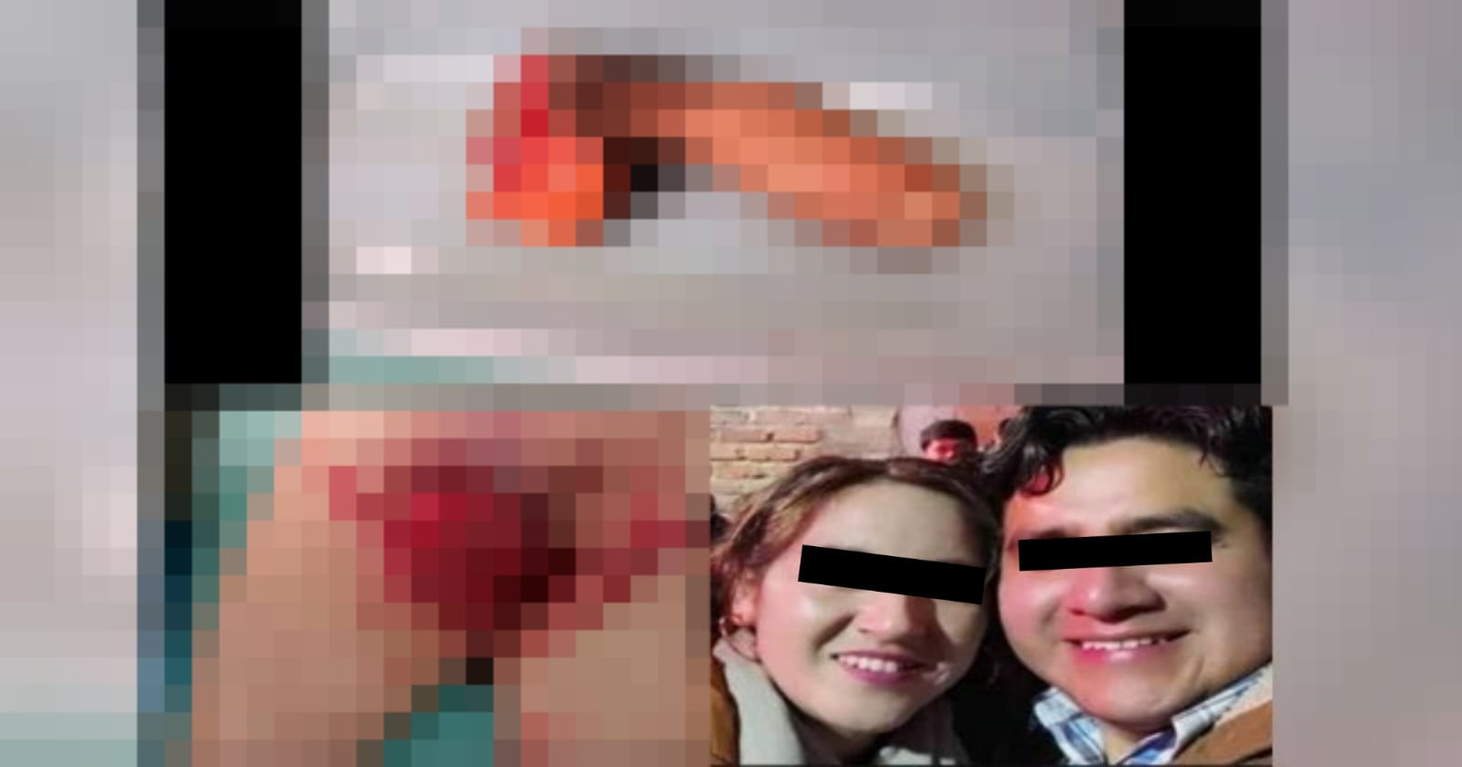 [IMAGENES SENSIBLES] Mujer le corta el pene a su pareja por supuesta infidelidad: Perú