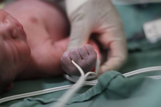 IMSS vigila sus 77 unidades de cuidados intensivos neonatales tras brote en Guadalajara