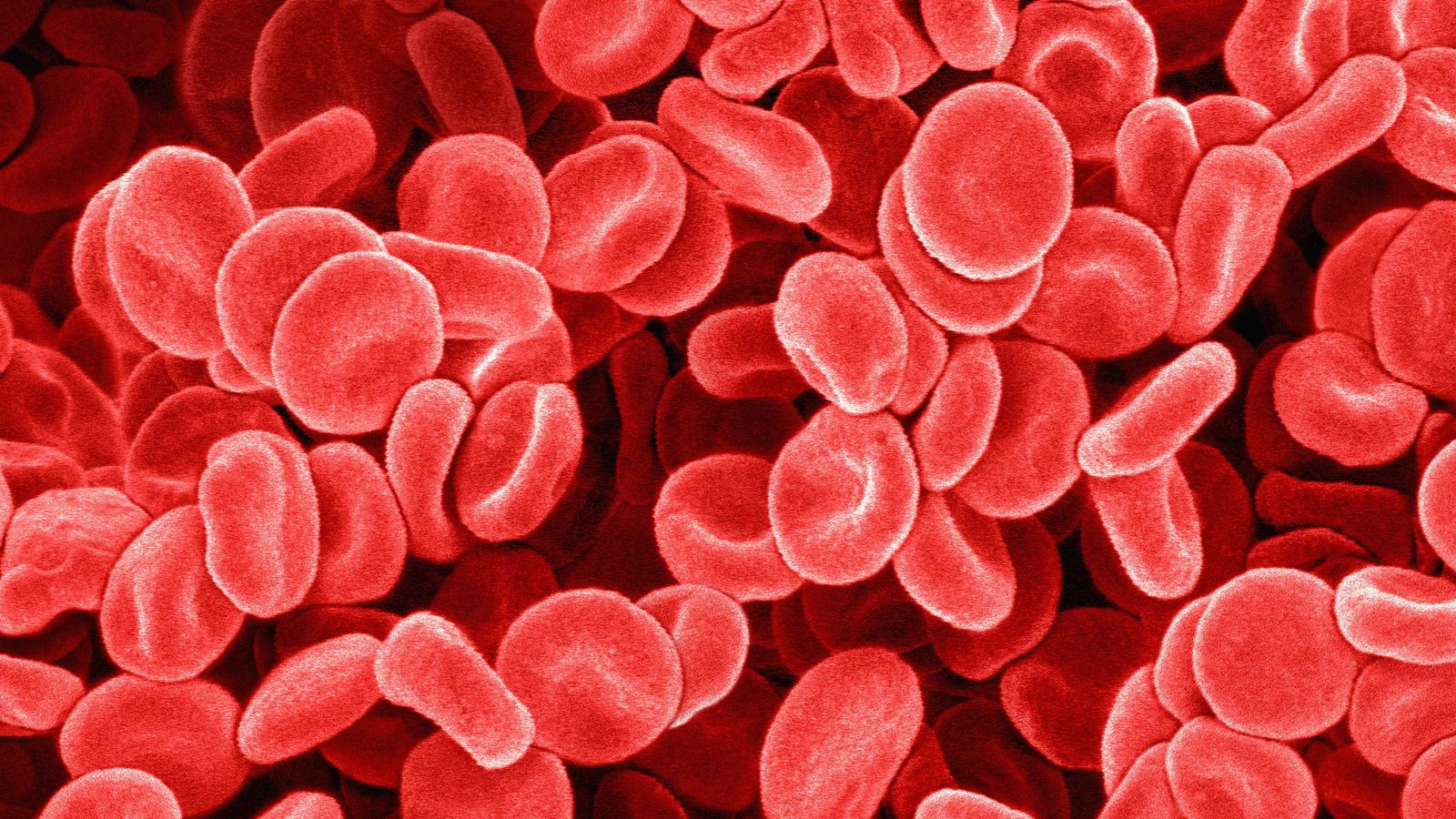 Entendiendo la hemofilia y sus tratamientos