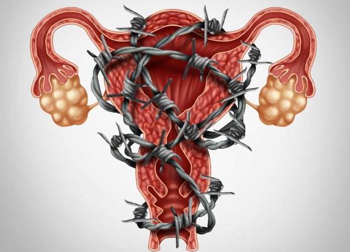 Menstruación y la dolorosa endometriosis