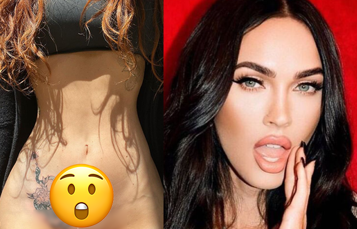 Megan Fox se deshace de sexy tatuaje en honor a su exesposo