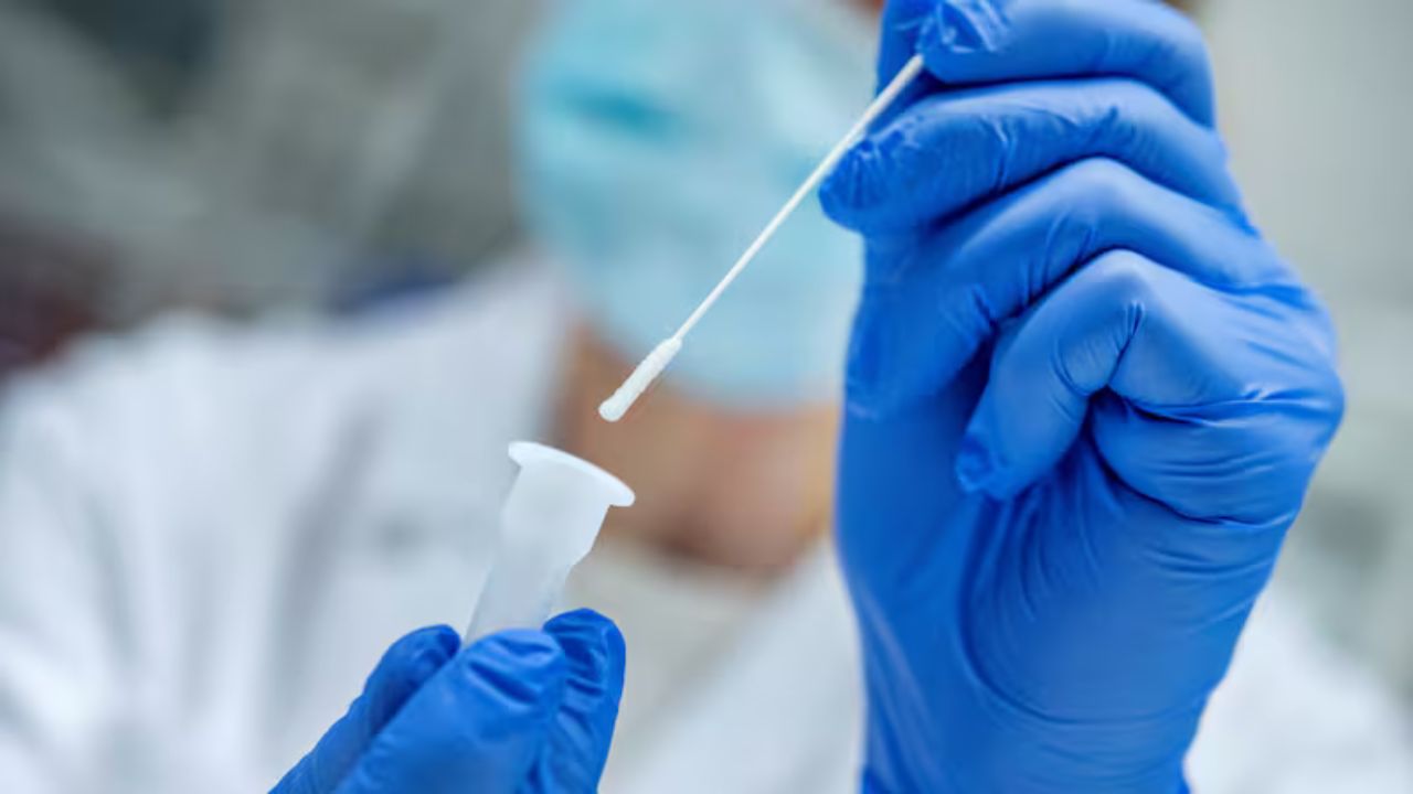 Sospechan peste neumónica en Siberia tras la muerte de una joven de 28 años en un laboratorio