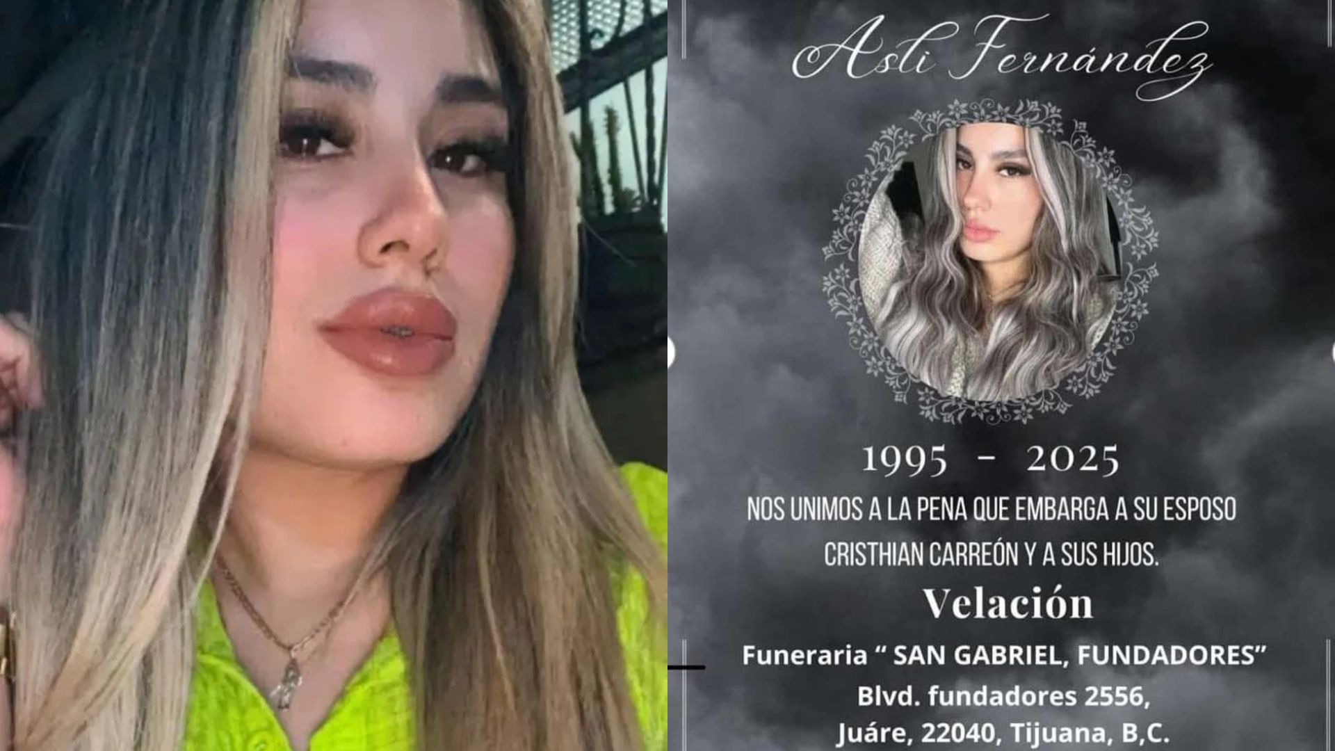 Fallece la influencer y manicurista Aslin Fernández tras someterse a procedimiento estético "Mommy Makeover"