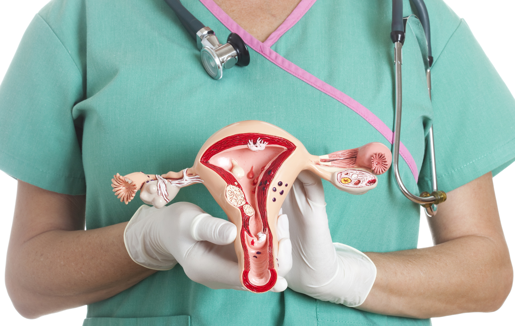 Cáncer de cuello uterino: Prevención y detección clave